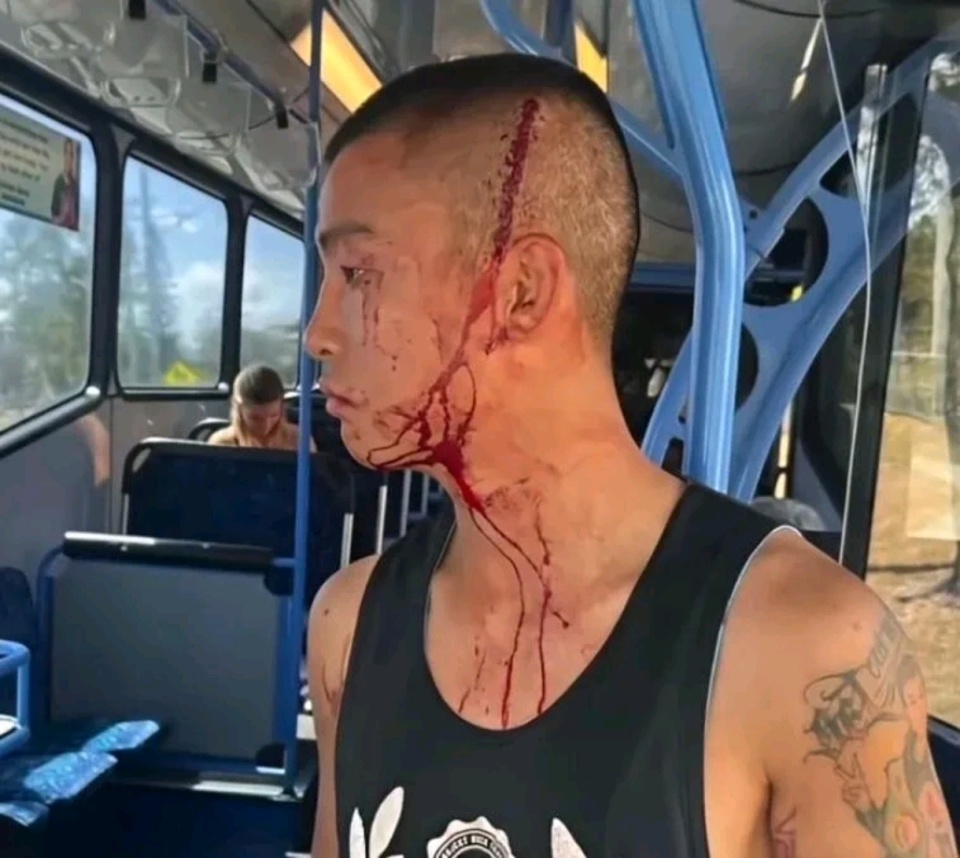 他的妻子腰, gprss, gtimg